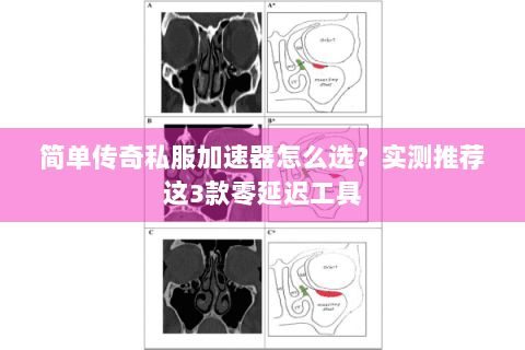简单传奇私服加速器怎么选？实测推荐这3款零延迟工具