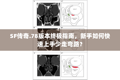SF传奇.78版本终极指南，新手如何快速上手少走弯路？